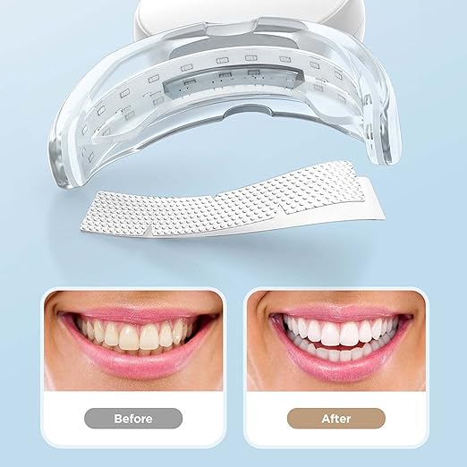 Teeth Cleaning & Whitening Kit